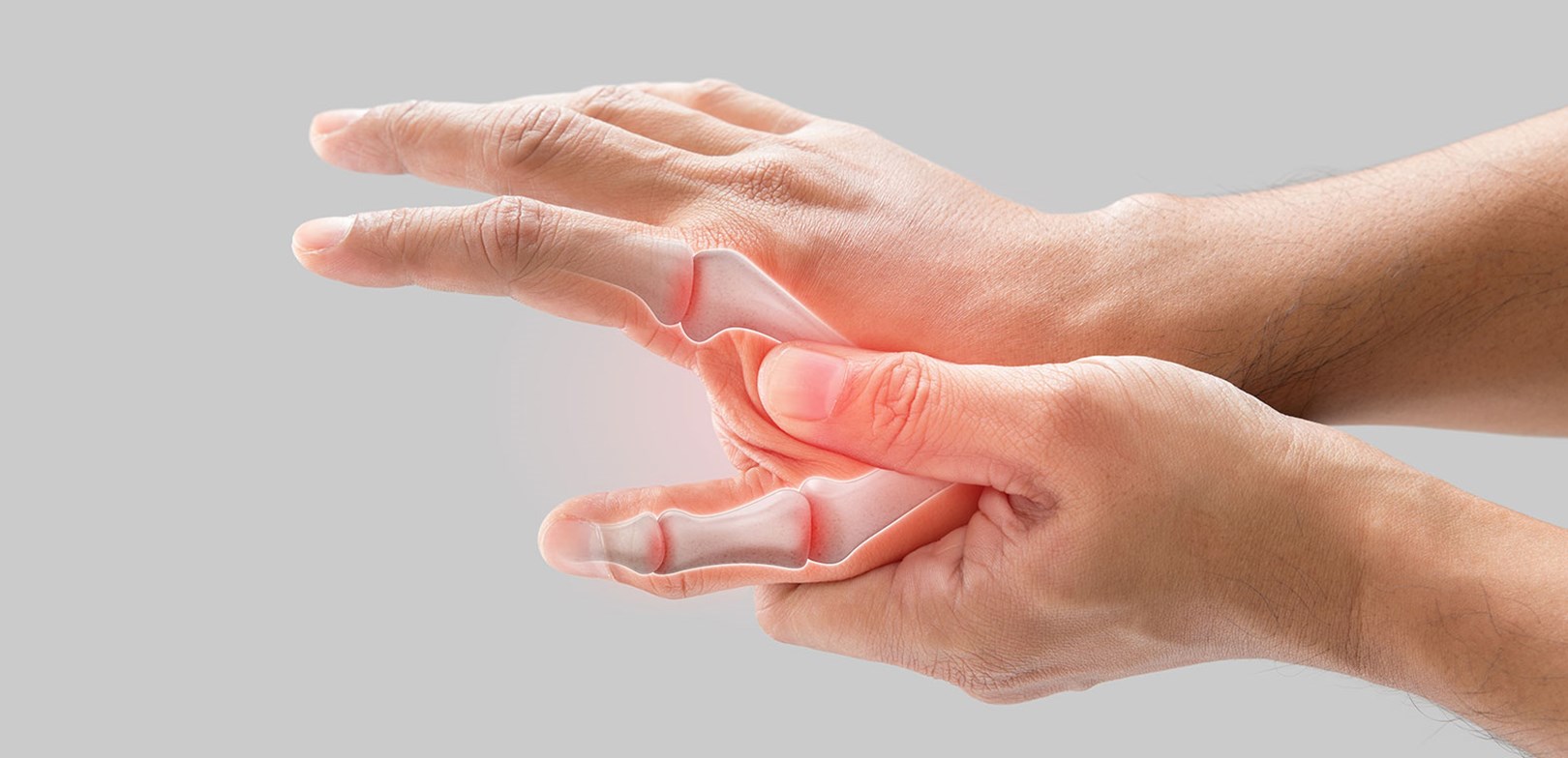  التهاب المفاصل الروماتيزمي Rheumatoid Arthritis (RA)